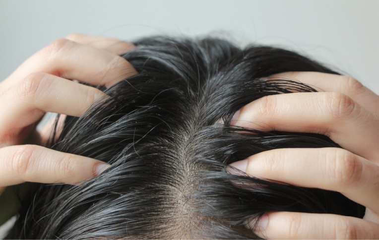 Close-up image of a girl touching her scalp with her hands.