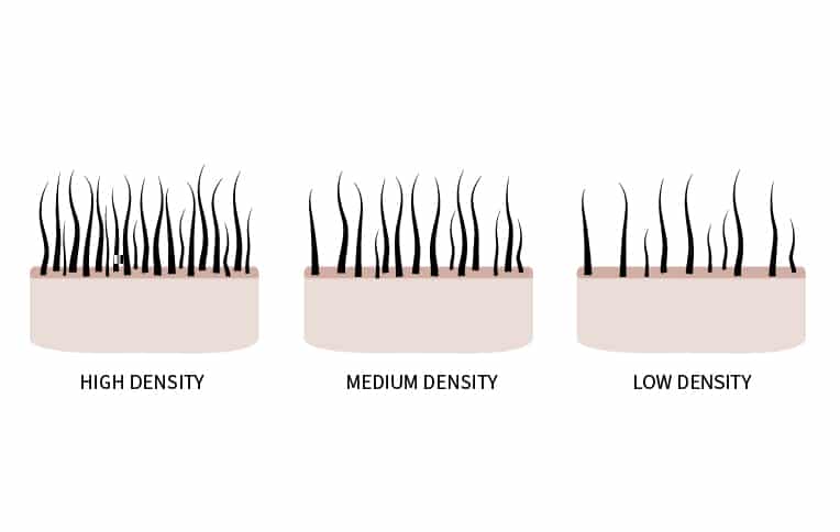 The image illustrates three types of hair density: high density with closely packed hair strands, medium density with moderately spaced hair strands, and low density with sparsely spaced hair strands.