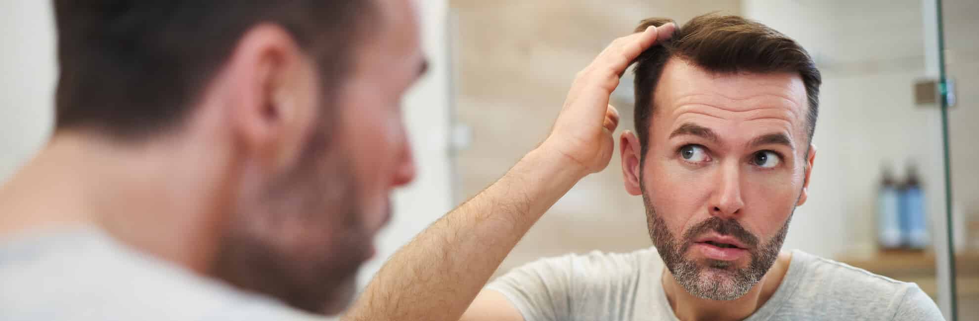 Hair Loss Treatment for Men: Causes & Prevention | Rossano Ferretti